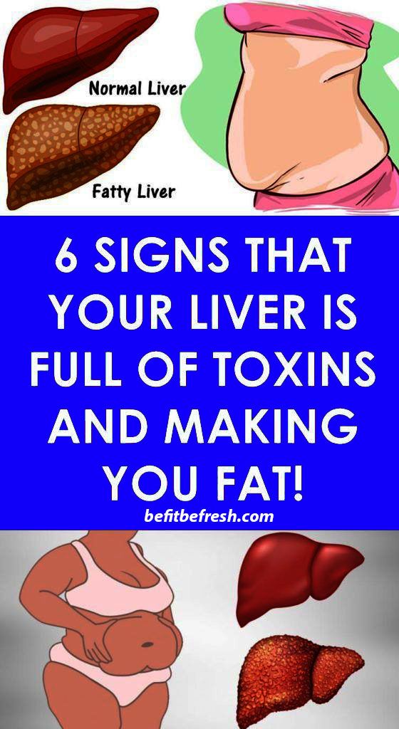 6 Clear Warning Signs Your Liver Is Full of Toxins and Making You Fat (How to Stop it)