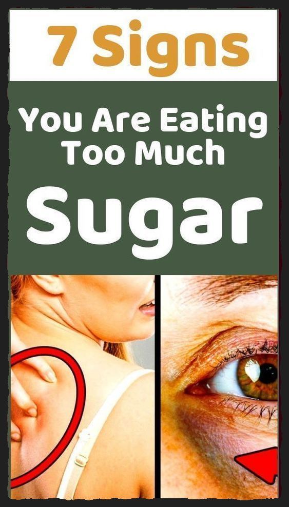 JUST 7 SIGNS YOU ARE EATING, TOO MUCH SUGAR!!!